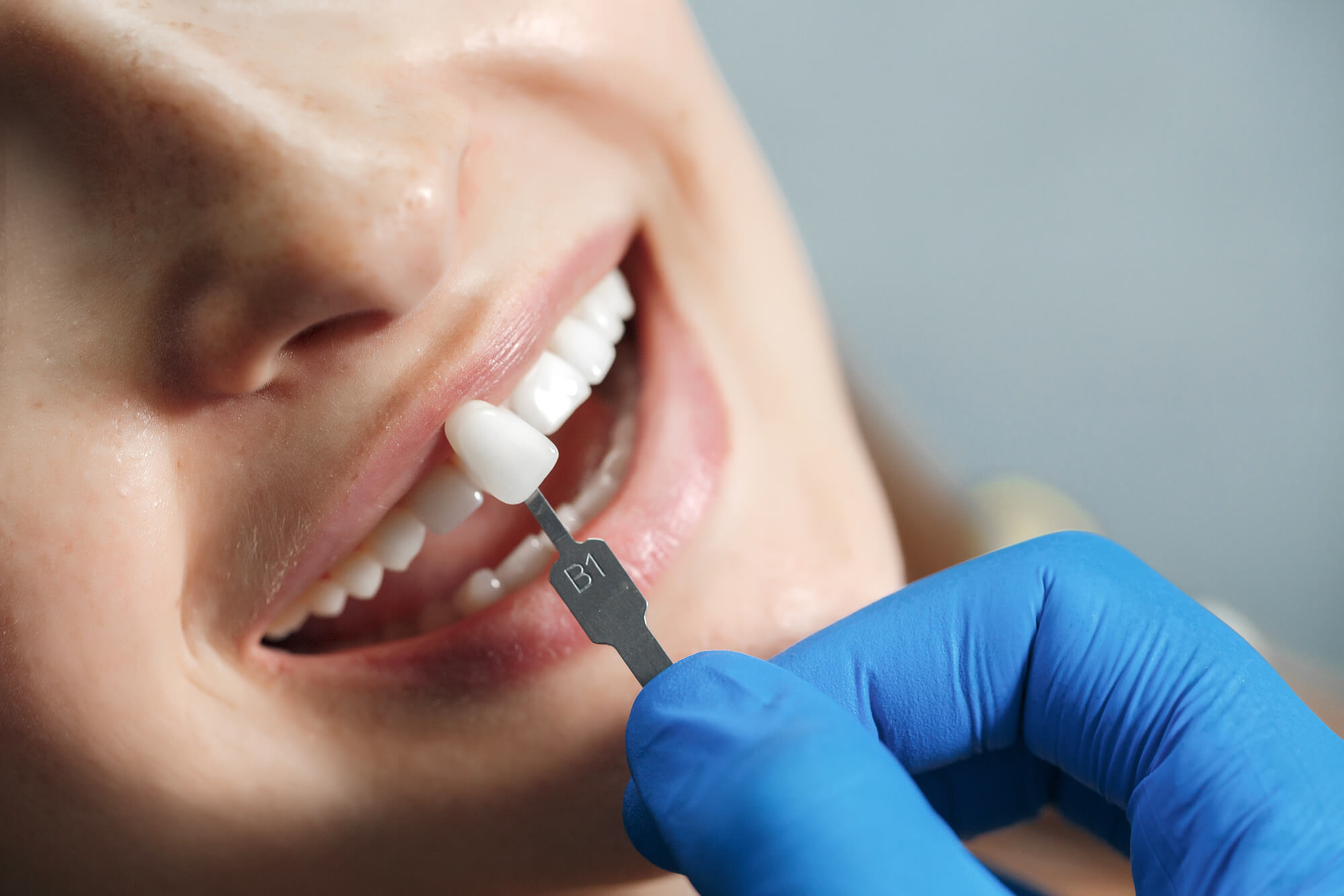 Dental Implants for Restoring Your Beautiful Smile