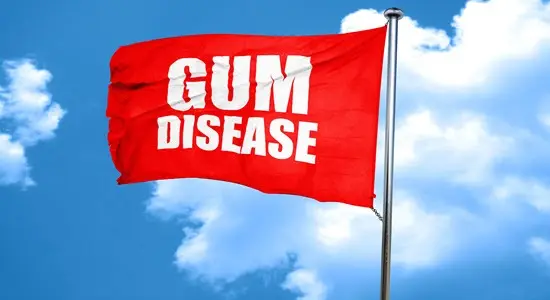 imgi_6_Gum-Disease-In-PIco-Rivera-CA