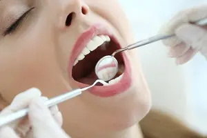 Dental Checkup at Direct Dental in Pico Rivera